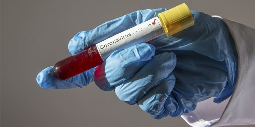 Kimler, Neden Koronavirüsü Ağır Geçiriyor? Şifresi Çözüldü!