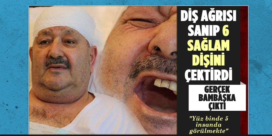 Diş Ağrısı Sanıp 6 Sağlam Dişini Çektirdi, Meğer Gerçek Bambaşka Çıktı